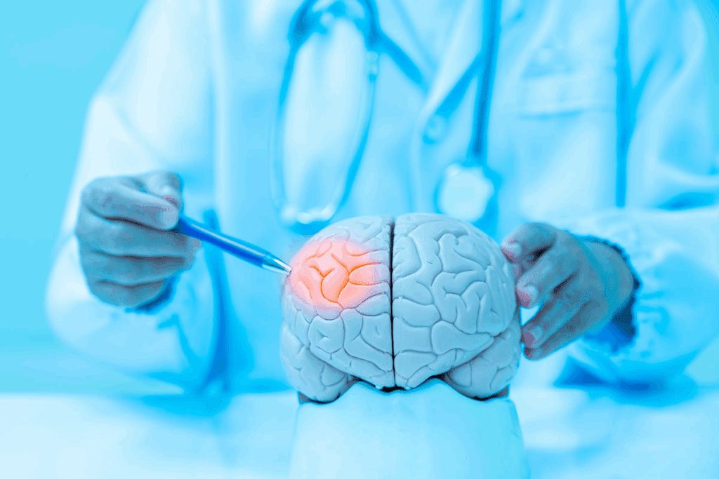 Brain Embolization Side Effects: 7 Facts