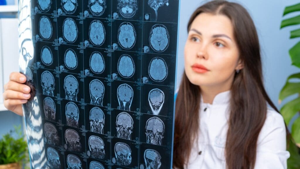 Brain Tumor Operation Survival Rates: 12 Key Prognosis Statistics for 2025