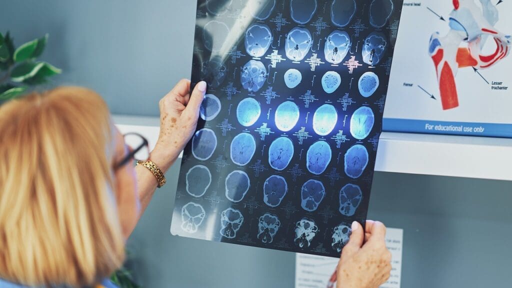 brain tumor types brain tumor types