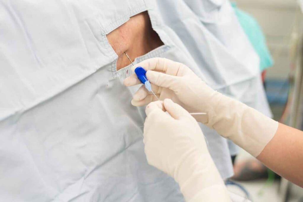 What to Do After Epidural Injection: 13 Care Steps