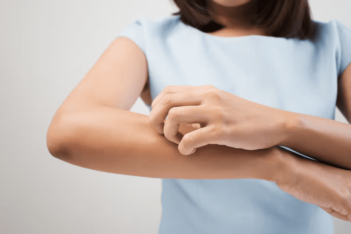 Leukemia Rash Child Pictures: 10 Common Types