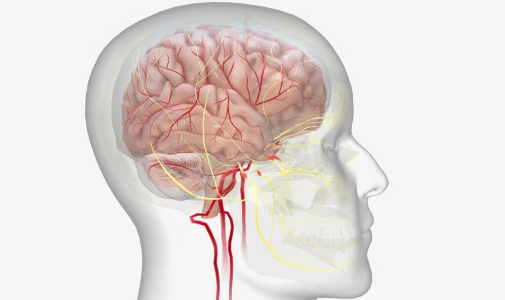 A detailed, anatomically accurate 3D visualization of an arteriovenous malformation (AVM) in the human brain