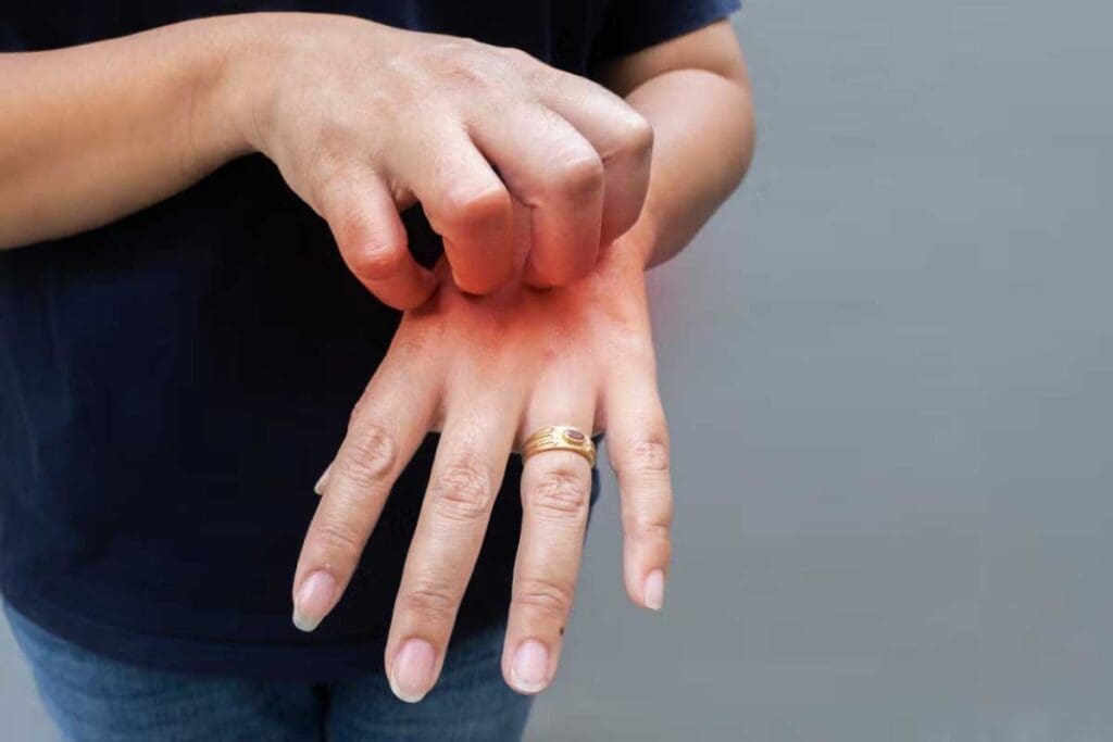 Petechiae Itchy: 8 Common Causes 3 Petechiae Itchy: 8 Common Causes