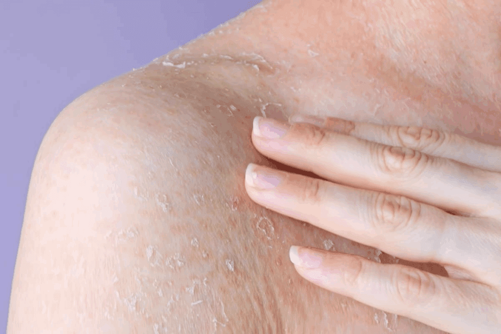 Can Itching Cause Petechiae? Facts 1 Can Itching Cause Petechiae? Facts