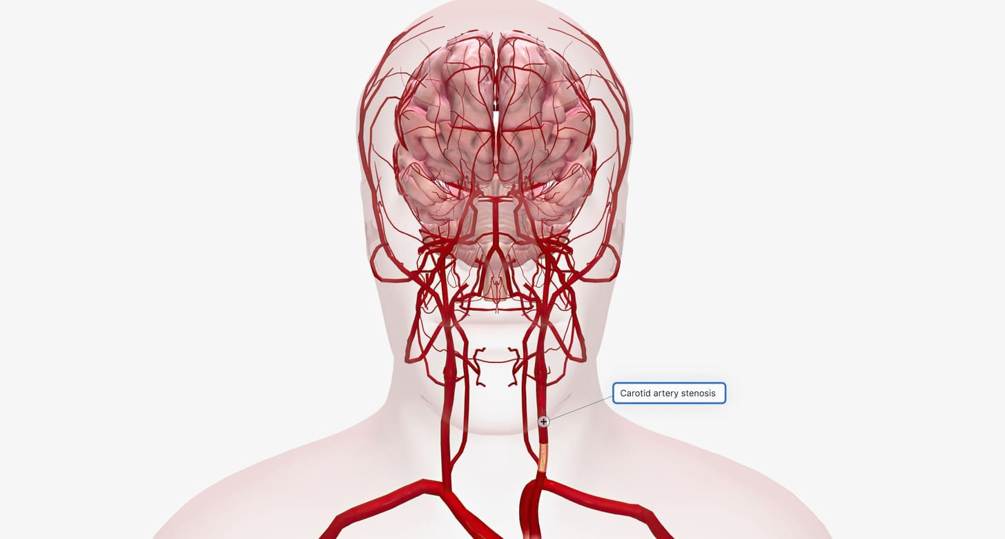 blood vessels in head LIV Hospital