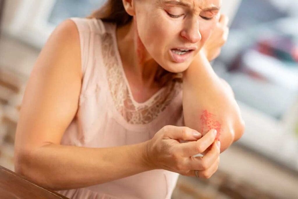 Petechiae Itchy: 8 Common Causes 2 Petechiae Itchy: 8 Common Causes
