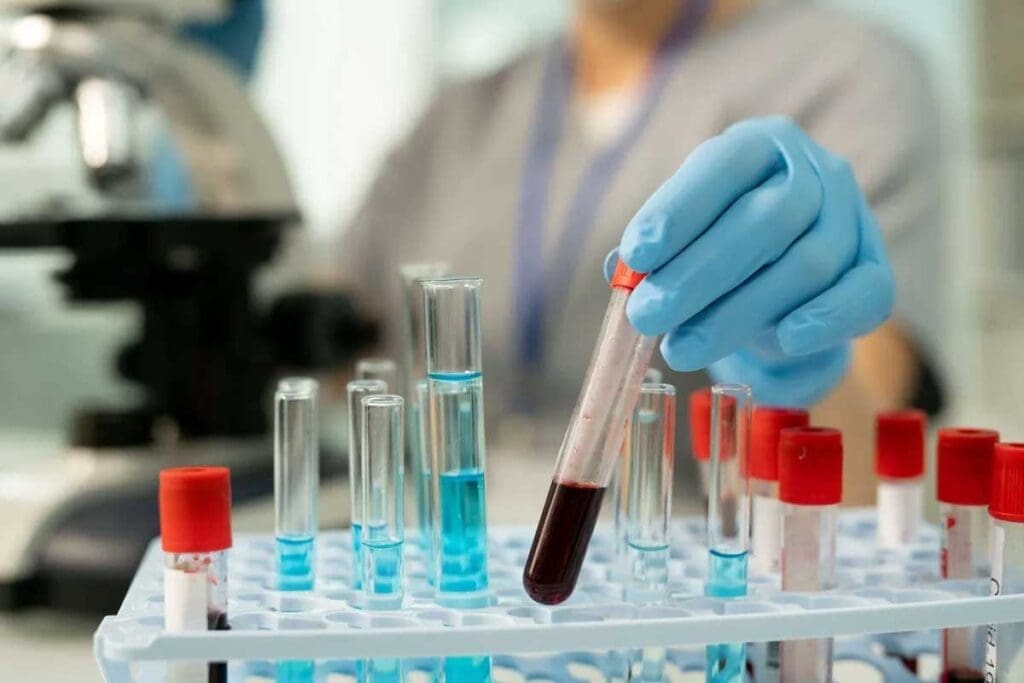 Does Blood Cancer Show Up in Routine Blood Work 2 Does Blood Cancer Show Up in Routine Blood Work