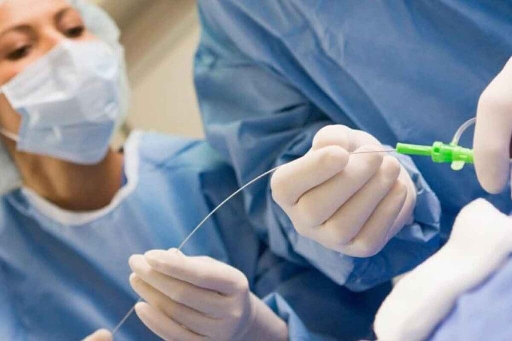 Balloon Artery Procedure: How It Works