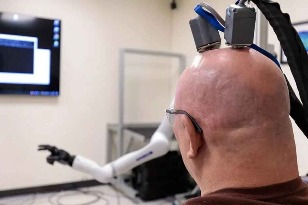 Cerebral Embolisation: 7 Key Facts About Brain Embolization Procedures 1 Cerebral Embolisation: 7 Key Facts About Brain Embolization Procedures