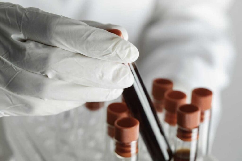 ERMS Cancer: Main Types and Treatments 2 ERMS Cancer: Main Types and Treatments