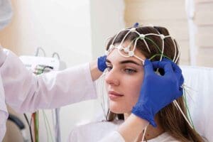 Brain Embolisation: Step-by-Step Guide
