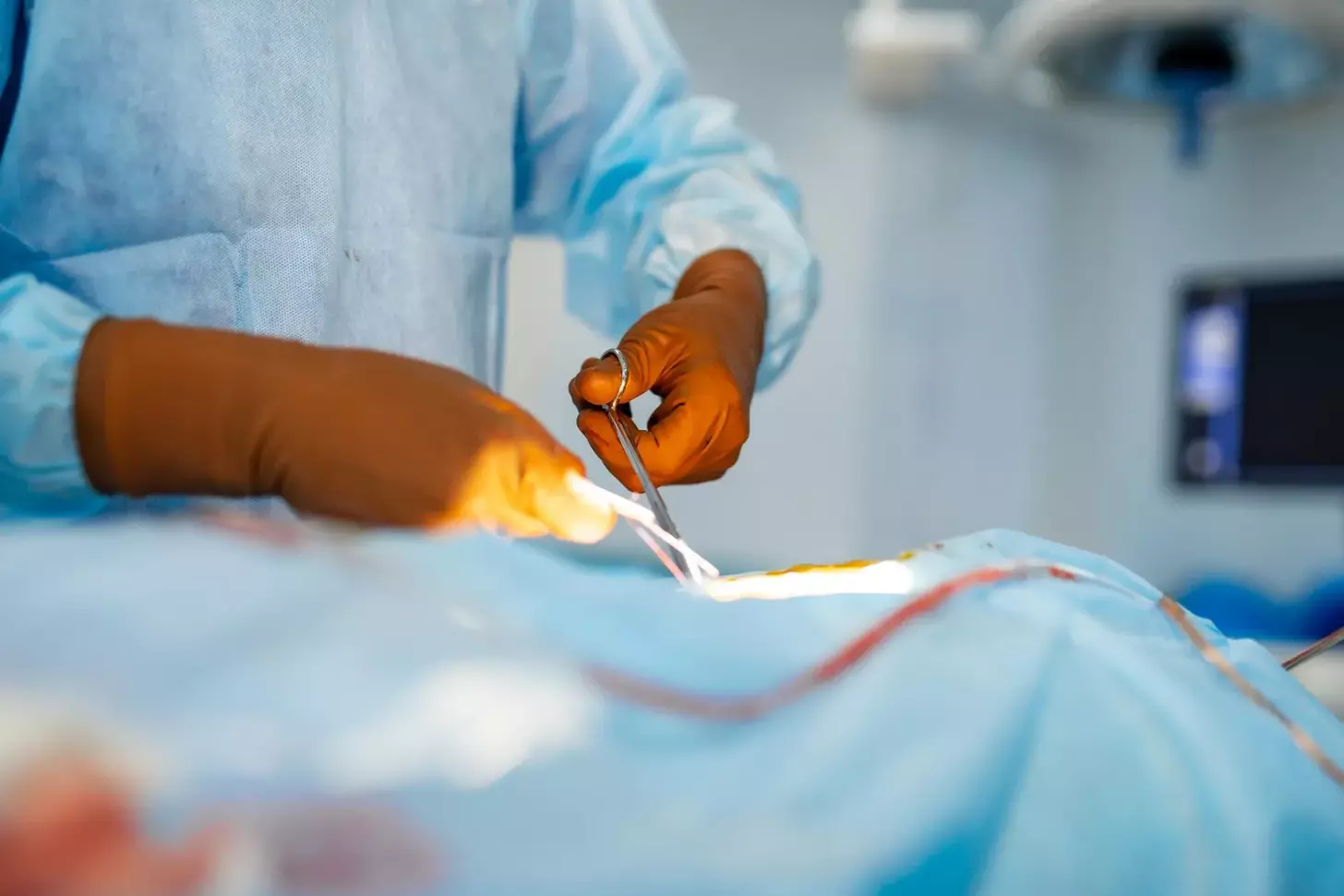 Endoscopic Heart Bypass Surgery: 7 Key Facts About TECAB, Recovery & Scars 1 Endoscopic Heart Bypass Surgery: 7 Key Facts About TECAB, Recovery & Scars