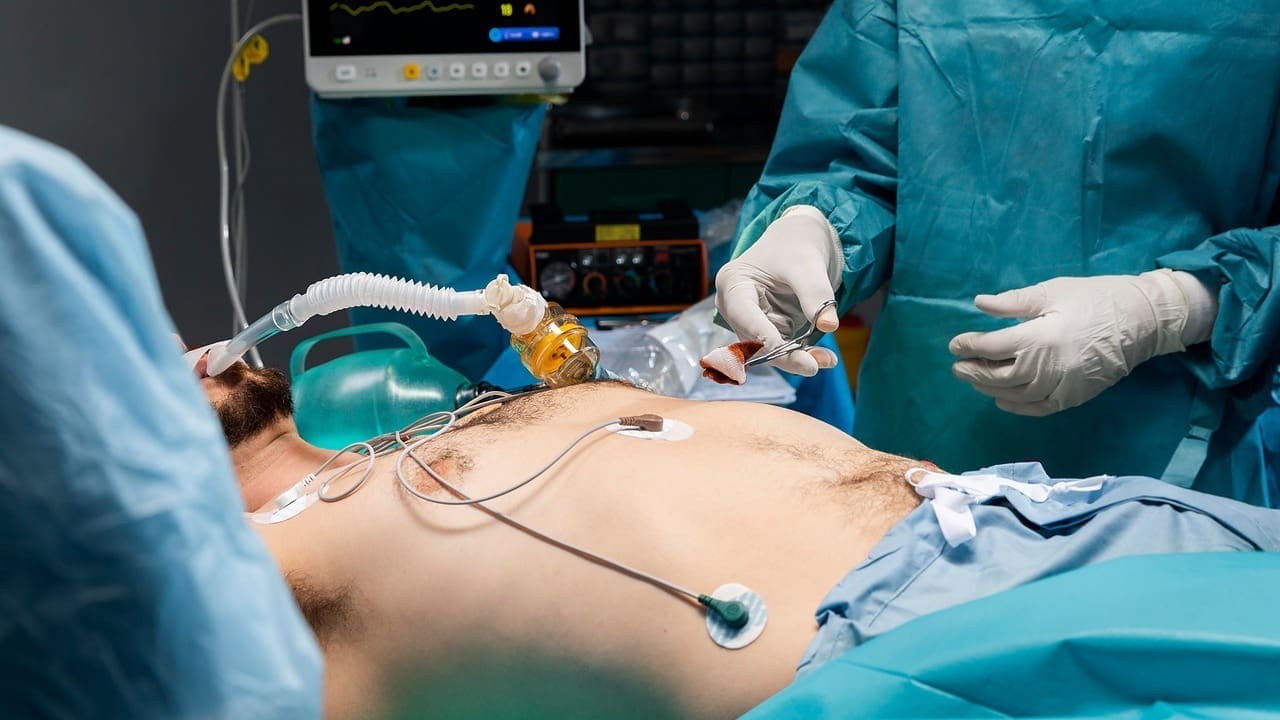 Abdominal Aneurysm Surgery: 7 Key Facts About