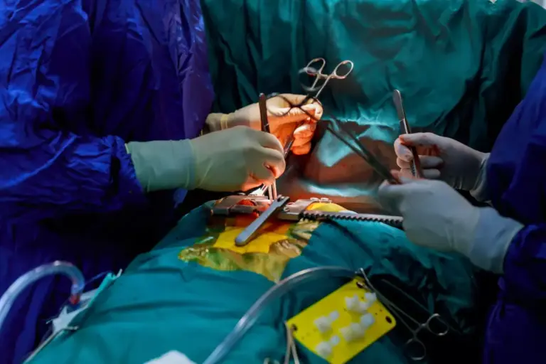 Endoscopic Cardiac Bypass: 7 Key Benefits and What to Expect from TECAB Surgery