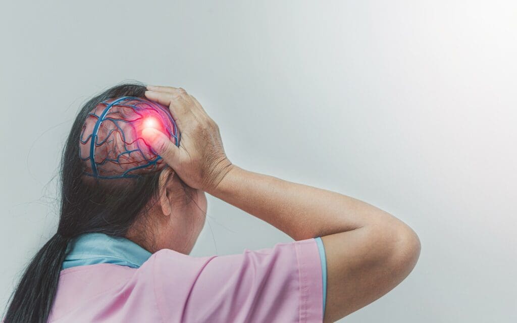 brain bleed brain bleed