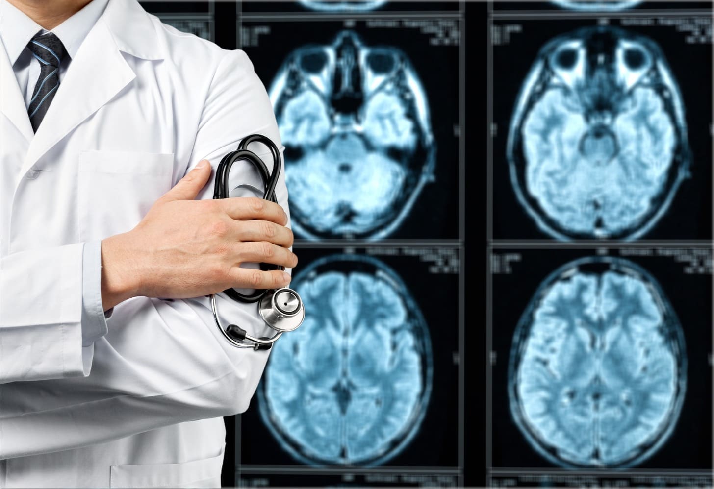 7 Key Findings a CT Scan Brain Bleed Can Show: Quick Guide
