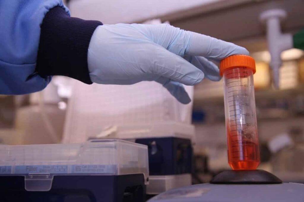 acute leukemia labs – 8 Essential Tests for Diagnosis