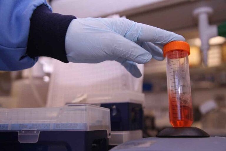 acute leukemia labs – 8 Essential Tests for Diagnosis