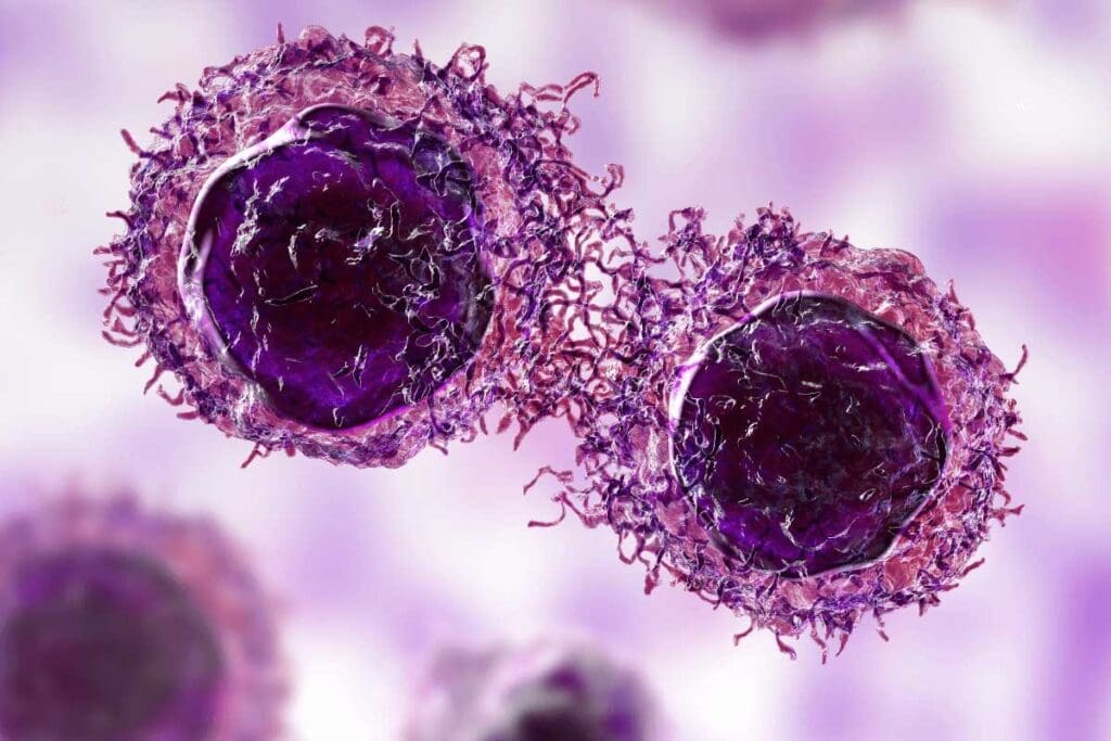 Ewing Sarcoma Lump: Appearance & Feel 3 Ewing Sarcoma Lump: Appearance & Feel