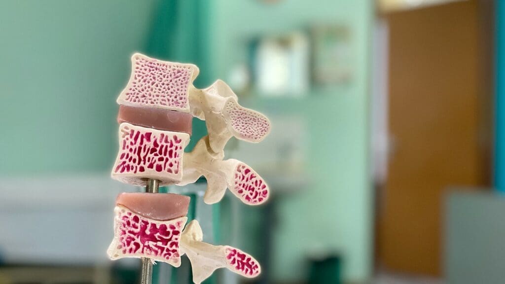 spinal cancer survival factors spinal cancer survival factors