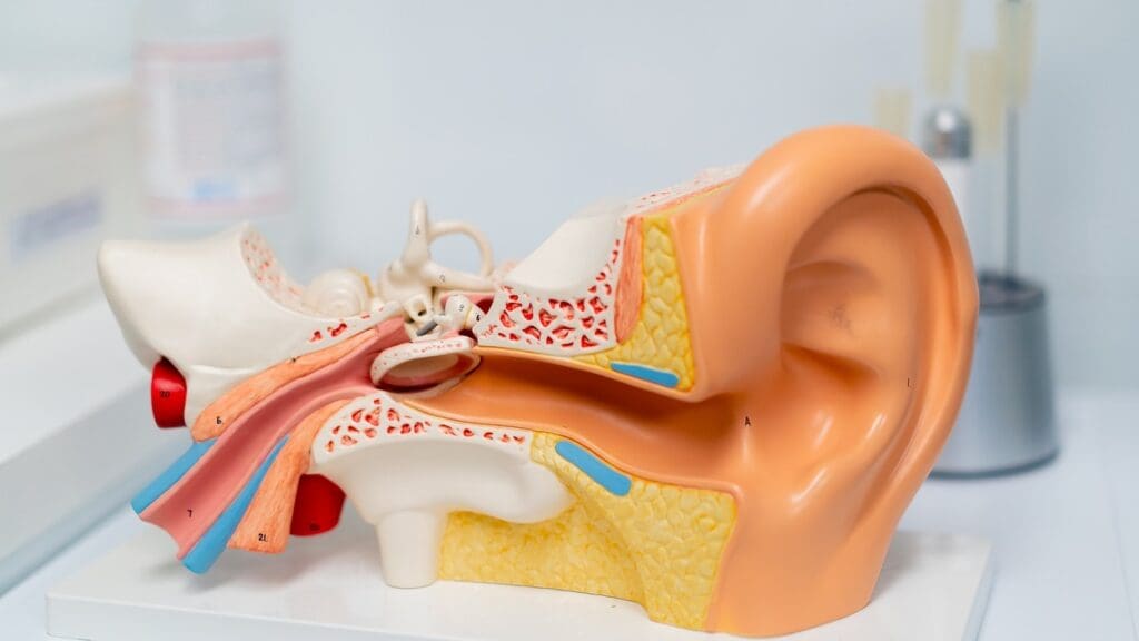acoustic neuroma definition