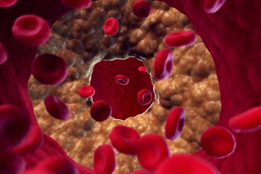 Signs of Clotting Disorder – 12 Key Symptoms Explained 2 Signs of Clotting Disorder – 12 Key Symptoms Explained