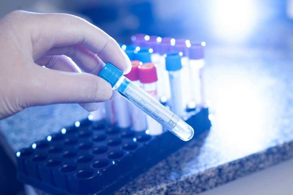 Coagulation Disorders — 7 Key Facts on Clotting Problems 1 image 7123 LIV Hospital