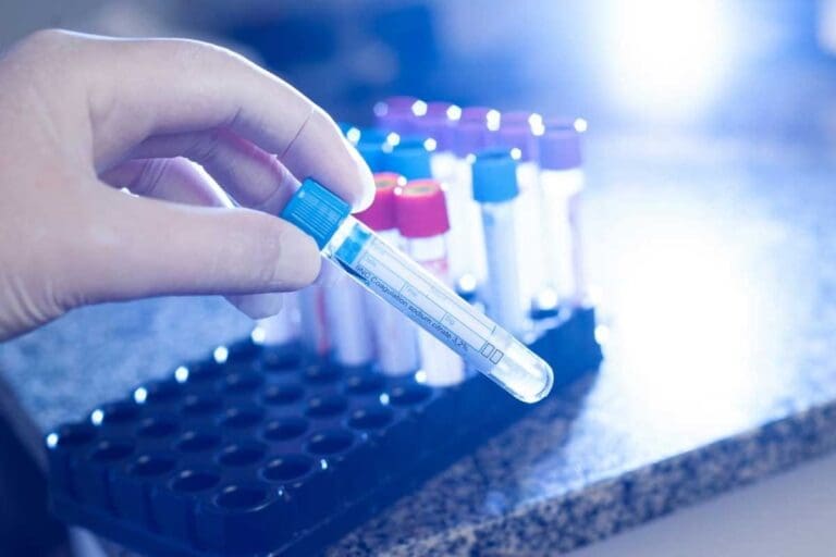 Coagulation Disorders — 7 Key Facts on Clotting Problems