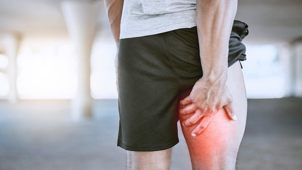 hamstring injury bruise