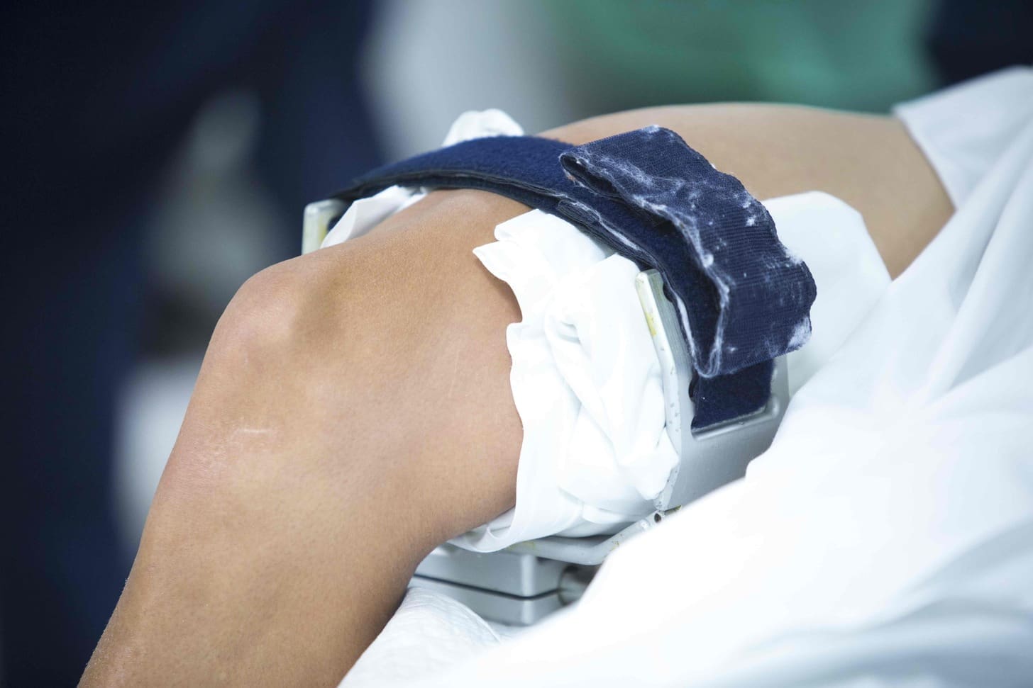 Knee Scope Surgery Recovery Time: 8 Key Facts for Faster Healing 1 Knee Scope Surgery Recovery Time: 8 Key Facts for Faster Healing