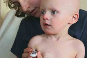 is childhood leukemia hereditary — Genetic Causes