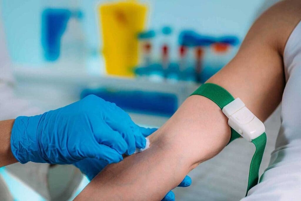 Skin Lymphoma Woman Signs of Leukemia in Adults: Top 10 Things to Know