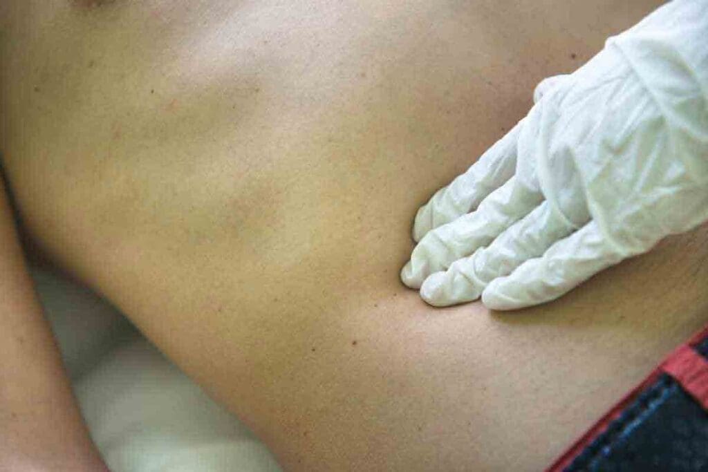 Childhood soft tissue sarcoma pictures — 6 Images to Recognize 2 Childhood soft tissue sarcoma pictures — 6 Images to Recognize