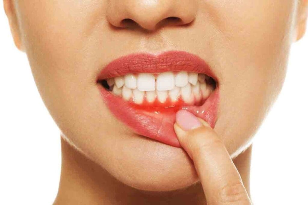 Coagulation Bleeding Disorders — 6 Key Facts Explained