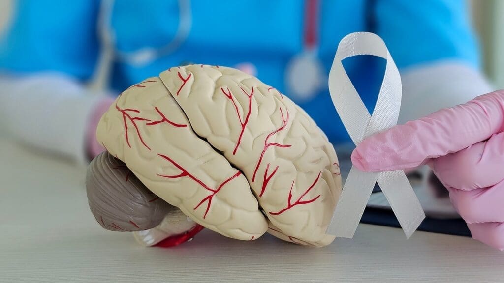 Acute Disseminated Encephalomyelitis Symptoms Acute Disseminated Encephalomyelitis Symptoms