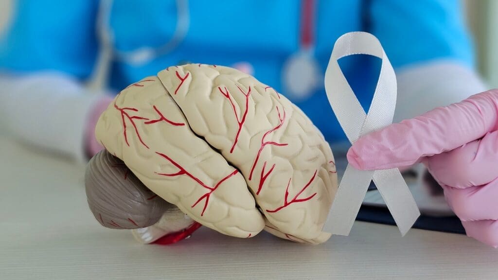 What Is Acute Disseminated Encephalomyelitis (ADEM) and How Does It Affect the Brain? What Is Acute Disseminated Encephalomyelitis (ADEM) and How Does It Affect the Brain?