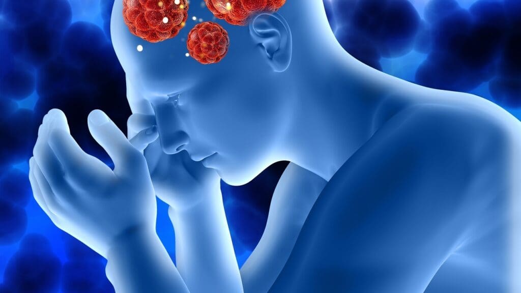 Acute Disseminated Encephalomyelitis Acute Disseminated Encephalomyelitis