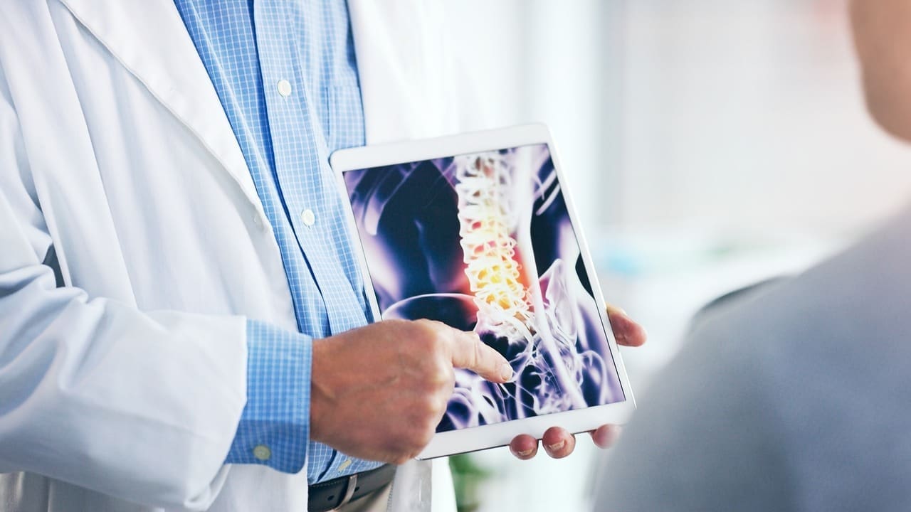 Anterior Cervical Discectomy: 7 Key Facts About ACDF Spine Fusion Surgery