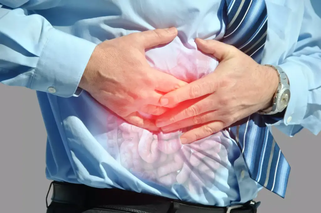 Stomach Aneurysm Rupture