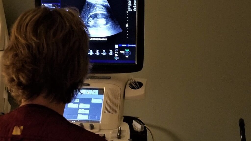 aortic aneurysm screening