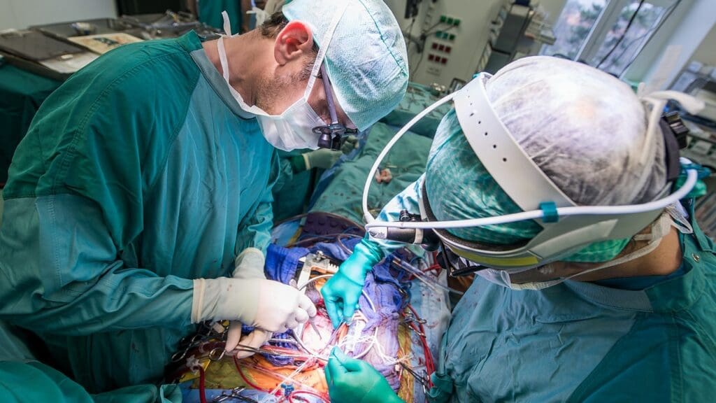 Abdominal Aortic Aneurysm