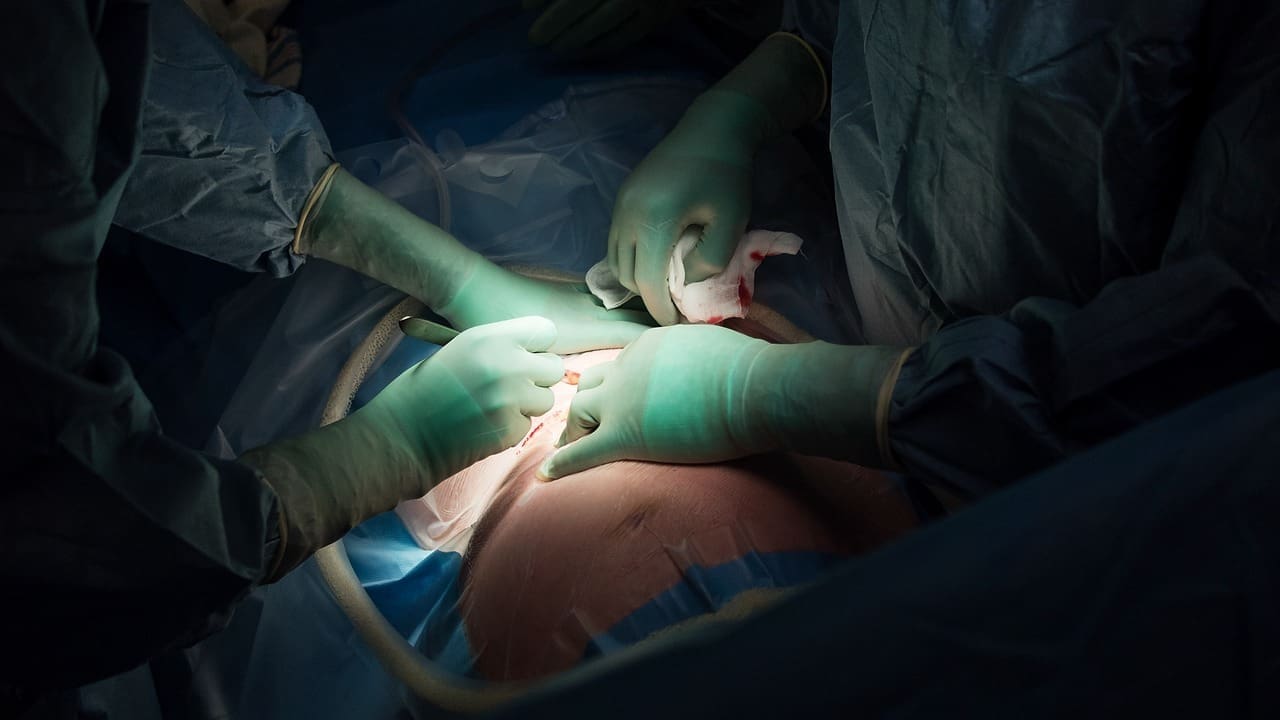 What Is AAA Repair Surgery and How Is Triple A Aneurysm Treated?