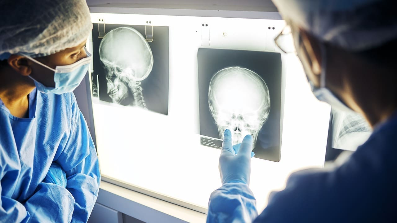 Meningioma Tumor Surgery Recovery: 7 Essential Facts You Should Know