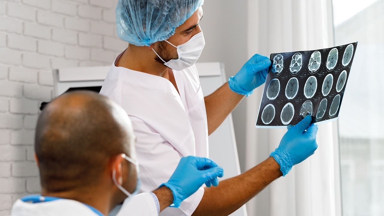 How Long Does Brain Swelling After Brain Surgery Last and How Is It Treated?