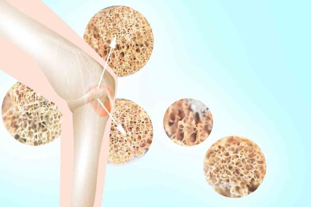 Bone Marrow Abnormality: Types and Key Causes 3 Bone Marrow Abnormality: Types and Key Causes