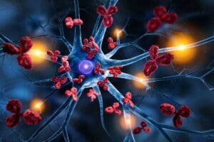 Anemia Autoimmune Disease: Key Causes & Terminology