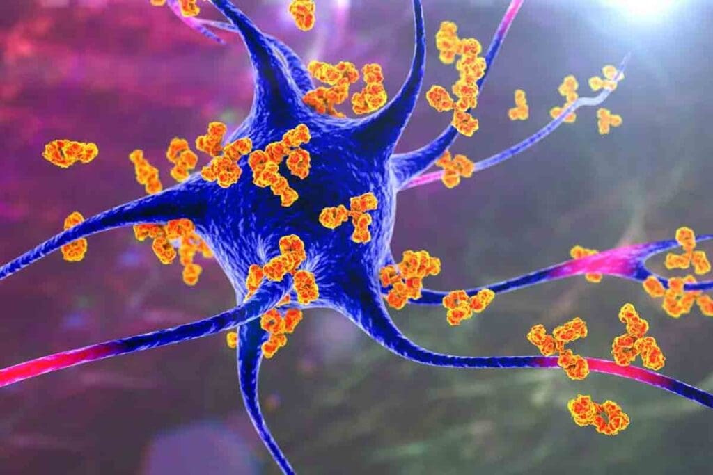 Autoimmune Diseases That Cause Anemia: 7 Key Conditions