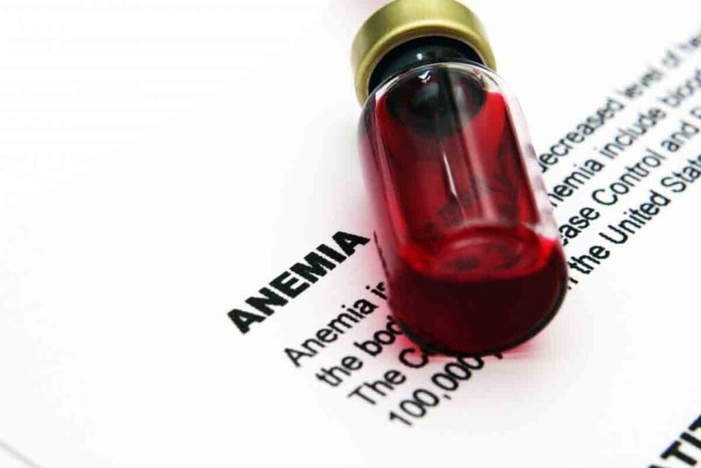 Can You Die of Anemia? Risks and Lifespan Facts 2 Can You Die of Anemia? Risks and Lifespan Facts
