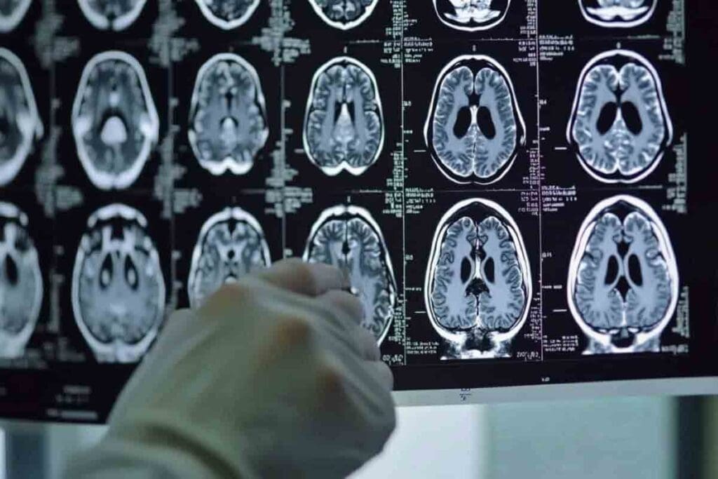Cerebellar Tumor Symptoms: 15 Key Brain Tumor Warning Signs