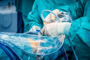 Orthopedic Surgery Complication Facts